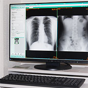 胸部・腹部X線（レントゲン）検査